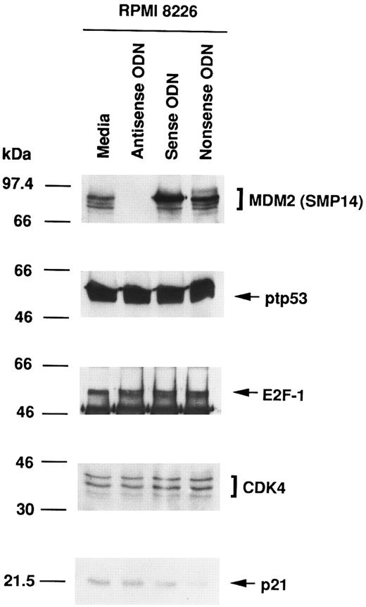 Fig. 2. Effect of culture with MDM2 antisense ODN on expression of MDM2, p53, E2F-1, CDK4, and p21 proteins in RPMI 8226 MM cells. RPMI 8226 MM cells were cultured in media alone or with MDM2 antisense, sense, or nonsense ODNs for 4 hours. Total cell lysates were immunoprecipitated and immunoblotted with SMP14 anti-MDM2 MoAb, AB-6 anti-ptp53 MoAb, C-20 anti–E2F-1 MoAb, H-22 anti-CDK4 pAb, and C-19 anti-p21 pAb.