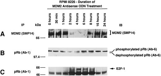 Fig. 6. Effect of culture with MDM2 antisense ODN on expression of MDM2, phosphorylation of pRB, and pRB–E2F-1 binding in RPMI 8226 MM cells. RPMI 8226 MM cells were cultured with 1.0 μmol/L MDM2 antisense ODN (A15) for up to 24 hours. Cell lysates prepared before and at 0.5, 1, 2, 4, 6, 8, 16, and 24 hours were immunoprecipitated with SMP-14 anti-MDM2 MoAb and blotted with the same Ab (A). Cell lysates were immunoprecipitated with Ab-1 C36 anti-pRB MoAb, followed by immunoblotting with Ab-6 AF11 anti-pRB MoAb (B) or C-20 anti–E2F-1 MoAb (C).