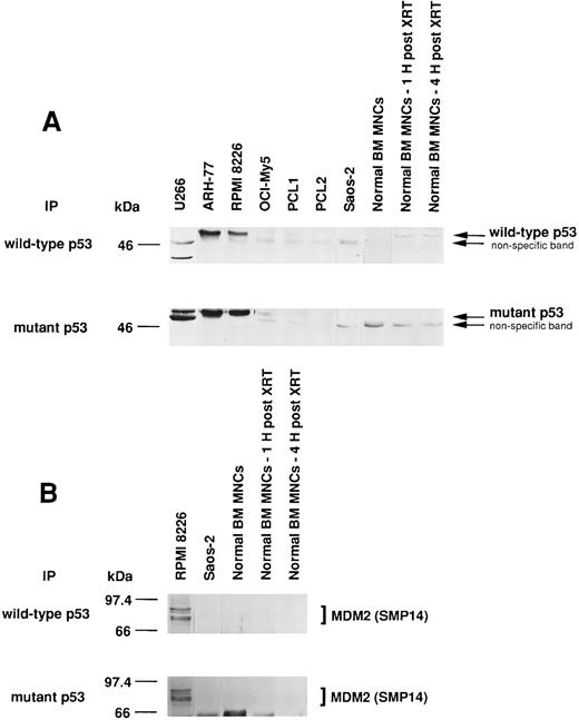 Fig. 7. Expression of wtp53 and mtp53, as well as p53-MDM2 binding, in MM-derived cell lines, PCL patient cells, Saos-2 osteosarcoma cells, and normal BM MNCs. Total cell lysates of MM cell lines (U266, ARH-77, RPMI 8226, and OCI-My5), PCL patient cells (PCL1 and PCL2), Saos-2 p53-deficient osteosarcoma cells, and normal BM MNCs (without or 1 or 4 hours post-XRT) were immunoprecipitated with Ab-5 anti-wtp53 MoAb or Ab-3 anti-mtp53 MoAb and immunoblotted with DO-1 hrp anti-ptp53 MoAb. Normal BM MNCs served as a positive control for wtp53; U266 MM cells served as a positive control for mtp53; and p53-deficient Saos-2 cells served as a negative control for both wtp53 and mtp53 (A). Total cell lysates of RPMI 8226, Saos-2 osteosarcoma cells, and normal BM MNCs (without or 1 or 4 hours post-XRT) were immunoprecipitated with Ab-5 anti-wtp53 MoAb or Ab-3 anti-mtp53 MoAb, followed by immunoblotting with SMP14 anti-MDM2 MoAb (B).