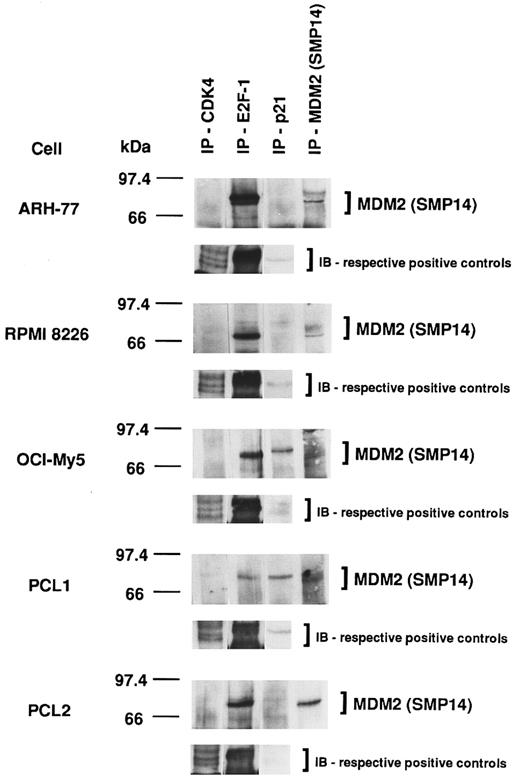 Fig. 8. Association of MDM2 with cell-cycle regulatory proteins in p53-positive and p53-negative MM-derived cell lines and PCL patient cells. Total cell lysates of MM cell lines (ARH-77, RPMI 8226, and OCI-My5) and PCL patient cells (PCL1 and PCL2) were immunoprecipitated with H-22 anti-CDK4 pAb, C-20 anti–E2F-1 MoAb, C-19 anti-p21 pAb, or SMP14 anti-MDM2 MoAb, followed by immunoblotting with SMP14 anti-MDM2 MoAb. These cell lysates were immunoprecipitated and immunoblotted using the same Abs as positive controls.