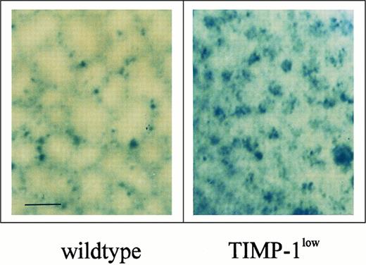 Fig. 3. Pattern of spontaneous liver metastases in moribund Timp-1low and wild-type mice. Whole-organ X-Gal staining showed a mosaic perilobular pattern in control wild-type mice. In livers of Timp-1low mice, a focal/clustered metastasis pattern was detected, showing effective infiltration of the parenchyma of the liver lobuli (bar, 0.5 mm).