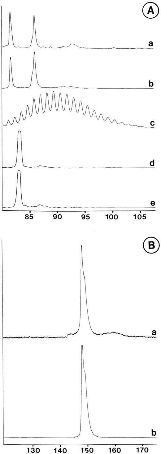 Fig. 3. Analysis of tumor-specific gene rearrangements in pre-pre-B-ALL human BM biopsies engrafted in SCID mice. During lymphoid development, exons encoding TcR and Ig are assembled by a site-specific V(D)J recombination. The joining of coding ends is imprecise, and base loss or addition occurs. As a consequence, PCR amplification of TcR or IgH loci of polyclonal lymphocytes yields products of heterogenous size, reflecting the diversity of the N-region. This can be evidenced by size separation using polyacrylamide gel electrophoresis, which shows a gaussian distribution of PCR products according to size. Conversely, electrophoresis of amplification products obtained from a monoclonal population of lymphoid cells with a given rearranged locus results in a single peak. This latter observation is consistent with the presence of a unique N-region in all lymphocytes, and is thus characteristic of a malignant clone. The size of the rearrangement is highly clone-specific. To look for the presence of blastic cells in BM biopsies, mononucleated cell DNA from tissues before and after engraftment was amplified using fluorescein-labeled oligonucleotides and submitted to high-resolution polyacrylamide electrophoresis on a fluorescent automated laser DNA sequencer. PCR products were detected by fluorescence and visualized as peaks separated according to size. (A) Blast cells from sample R41 engrafted for 11 weeks contain a clonal IgH rearrangement on both alleles (b), identical to that detected in the biopsy before implantation (a). Similarly, R49 blast cells exhibit the same single-allele IgH rearrangement before (e) and after (d) a 6-week implantation in a SCID mouse. As a control, polyclonal IgH rearrangements present in a normal BM cell population were used (c). (B) The same Vγ9-J1J2 single-allele rearrangement is detected in R44 blasts analyzed at first diagnosis (b) and after transplantation of the BM biopsy in a SCID mouse for 5 weeks (a). Y-axis, intensity of fluorescence; X-axis, time (min).