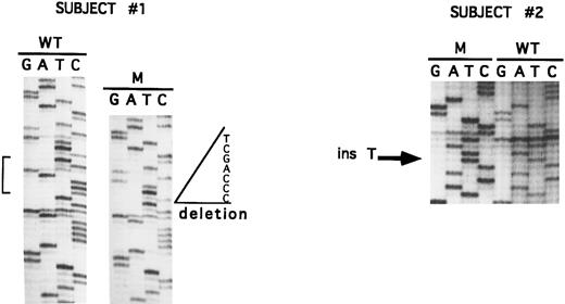 Fig. 1. Sequence analysis of exon 8 of subject 1 and subject 2.