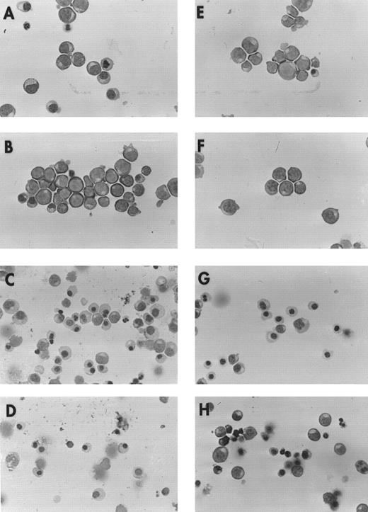 Fig. 1. Morphology of erythroblasts from normal donors and patients with DBA. Cytocentrifuge preparations were prepared from day 10 and 14 BFU-E–derived erythroblasts cultured with or without 100 ng/mL SCF. BFU-E–derived erythroblasts from a representative normal donor are shown at day 10 (A, −SCF; B, +SCF ), and day 14 (C, −SCF; D, +SCF ) and from a patient with transfusion-dependent DBA at day 10 (E, −SCF; F, +SCF ) and 14 (G, −SCF; H, +SCF ) of maturation. Preparations made from three additional patients and normal donors showed similar results.
