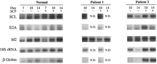 Fig. 5. RT-PCR of SCL, E2A, Id2, 18S rRNA, and β-globin. Results of studies on day 7, 10, and 14 BFU-E–derived cells from a representative normal donor and from day 10 and 14 cells from two patients with transfusion-dependent DBA. BFU-E were stimulated with or without 100 ng/mL SCF. The same patients (1 and 2) studied in Figs 2, 3, and 4 are shown for comparison of protein and mRNA levels.