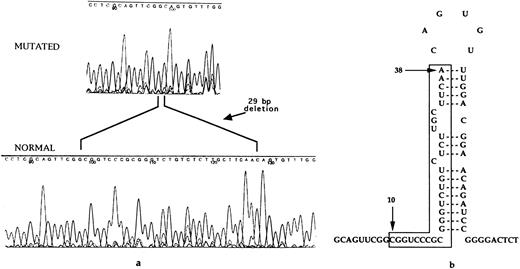 Fig. 3. (a) DNA automatic sequence, showing in one affected family member the presence of a 29-bp deletion, involving the IRE stem-loop. (b) Representation of the IRE located in the 5′ UTR of L-ferritin. The nucleotides found to be deleted in this HHCS family are marked between lines. They correspond to the whole 5′ sequence involved in base pairing to form the IRE stem. The IRE stem-loop secondary structure is thus predicted to be completely lost, leading to lack of the negative control by sequence/structure specific binding of IRPs.