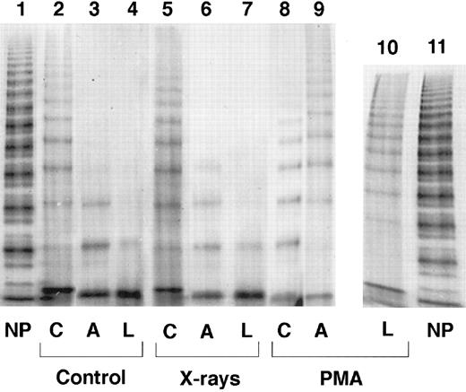 Fig. 1. Multimeric composition of vWF, analyzed by electrophoresis under nonreducing conditions on a 2.5% sodium dodecyl sulfate-agarose gel. At 48 hours samples were taken from the cellular (C), abluminal (A), and luminal (L) compartment of quiescent cells (lanes 2 through 4), 20 Gy single-dose irradiated cells (lanes 5 through 7), and PMA-stimulated cells (lanes 8 through 10). Lanes 1 and 11, normal plasma; lanes 10 and 11 were derived from the same experiment, run on a separate gel.