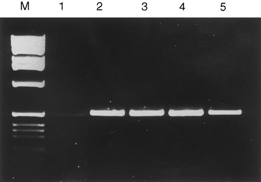 Fig. 1. Agarose gel electrophoresis of platelet RT-PCR and cDNA library PCR fragments. Lane M, molecular-weight markers (1-kb ladder; GIBCO-BRL, Life Technologies Ltd, Paisley, UK); lanes 1 through 5 show a single 521-bp product amplified from the following sources. Lane 1, platelet cDNA; lane 2, HEL cell cDNA library; lane 3, K562 cDNA library; lane 4, U937 cDNA library; lane 5, HL60 cDNA library.