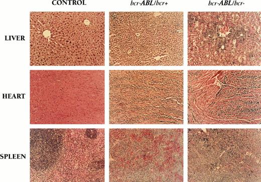Fig. 2. Histology of the acute leukemia disease in bcr-ABL/bcr+ and bcr-ABL/bcr− chimeric mice. Histologic analysis was performed when the mice were moribund. The spleen from bcr-ABL/bcr+ and bcr-ABL/bcr− chimeric mice that developed an acute leukemia shows the effacement of the normal spleen architecture (compared with control chimeric mice). Similar cells invade visceral organs such as the liver or the heart. Control chimeric mice were generated by injecting wild-type E14 cell clone or ES-E14 cells in which one bcr allele had been modified with the bcr targeting vector into blastocysts. Although the acute leukemia disease in bcr-ABL/bcr+ and bcr-ABL/bcr− chimeric mice was very similar, the level of leukemic infiltration shown by histologic analysis was not identical (original magnification ×50).