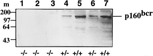 Fig. 3. Western blot analysis of bcr expression levels in control (+/+), heterozygote bcr-ABL/bcr+ (+/−), and homozygote bcr-ABL/bcr− (−/−) spleen extracts. The location of p160BCR is as indicated to the left. Lanes 1, 2, and 3 correspond to bcr-ABL/bcr− chimeric mice; lanes 4 and 6 correspond to bcr-ABL/bcr+ mice; and lanes 5 and 7 correspond to control chimeric mice.