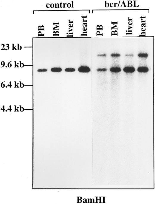Fig. 4. Genomic organization of the Ig heavy chain gene in bcr-ABL chimeric mice. DNA was obtained from control and bcr-ABL chimeric tissues, digested with BamHI, and fractionated into 1% agarose gel. Specific rearrangement was detected by Southern blot analysis with an Ig heavy chain specific probe in bcr-ABL chimeric tissues. PB, peripheral blood; BM, bone marrow.