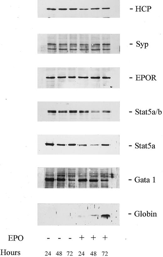 Fig. 1. Levels of expression of HCP, Syp, EPOR, Stat5, and GATA-1 are not modulated during EPO-induced globin expression in SKT6 cells. SKT6 cells (2.5 × 105 cells/mL) were cultured in the presence or absence of EPO (±10 U/mL) for the indicated intervals. Lysates then were prepared and were analyzed by Western blotting using antibodies to HCP, Syp, EPOR, Stat5a/b, Stat5a, GATA-1, and murine globins (as indexed in the right margin). For each lane, lysate from 2 × 105 cells was analyzed. For Syp, its correspondence to the upper protein of the two antigens detected was confirmed by the reprobing of stripped blots with a distinct Syp antibody (E.R.S., data not shown).