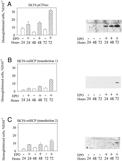 Fig. 4. The enforced expression of wt HCP in SKT6 cells inhibits EPO-induced globin expression, and hemoglobinization. (A through C) SKT6 cells were electrotransfected with pCINeowtHCP or pCINeo expression vectors, and stably transfected lines were isolated by selection in G418 (see the Materials and Methods). In assays of EPO-induced hemoglobinization and globin expression, cell lines were cultured at 2.5 × 105 cells/mL in the presence or absence of EPO (±2 U/mL). At 24, 48, and 72 hours of EPO exposure, frequencies of hemoglobinized cells were assayed by staining with DAF. Values are the means ± standard deviations of three replicate cultures. At each time interval, lysates also were prepared for assays of globin expression levels via Western blotting. For each lane, lysate from 2 × 105 cells was analyzed. For SKT6-wtHCP cells, data are for cell lines prepared from two independent transfections. / (D) In assays of EPO-induced Stat5a activation, SKT6 cell lines (parental SKT6.1B cells, and stably transfected SKT6.1B-wtHCP cells) were exposed to EPO (±50 U/mL) for 15 minutes. Lysates then were prepared and were incubated with a biotinylated PRE cassette. Levels of activated Stat5a were assayed by adsorption of Stat5a-DNA complexes to streptavidin agarose CL4B and ECL Western blotting after the elution of bound factor from washed gels (upper gels). As a control, levels of Stat5a in total lysates also were assayed by Western blotting (lower panel).