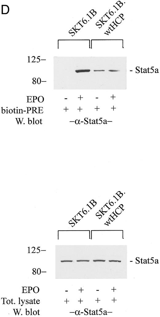 Fig. 4. The enforced expression of wt HCP in SKT6 cells inhibits EPO-induced globin expression, and hemoglobinization. (A through C) SKT6 cells were electrotransfected with pCINeowtHCP or pCINeo expression vectors, and stably transfected lines were isolated by selection in G418 (see the Materials and Methods). In assays of EPO-induced hemoglobinization and globin expression, cell lines were cultured at 2.5 × 105 cells/mL in the presence or absence of EPO (±2 U/mL). At 24, 48, and 72 hours of EPO exposure, frequencies of hemoglobinized cells were assayed by staining with DAF. Values are the means ± standard deviations of three replicate cultures. At each time interval, lysates also were prepared for assays of globin expression levels via Western blotting. For each lane, lysate from 2 × 105 cells was analyzed. For SKT6-wtHCP cells, data are for cell lines prepared from two independent transfections. / (D) In assays of EPO-induced Stat5a activation, SKT6 cell lines (parental SKT6.1B cells, and stably transfected SKT6.1B-wtHCP cells) were exposed to EPO (±50 U/mL) for 15 minutes. Lysates then were prepared and were incubated with a biotinylated PRE cassette. Levels of activated Stat5a were assayed by adsorption of Stat5a-DNA complexes to streptavidin agarose CL4B and ECL Western blotting after the elution of bound factor from washed gels (upper gels). As a control, levels of Stat5a in total lysates also were assayed by Western blotting (lower panel).