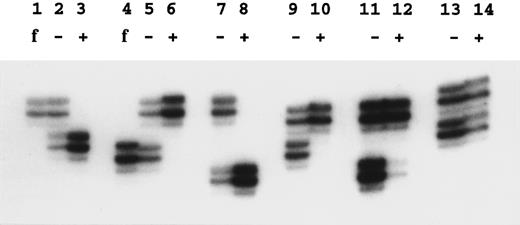 Fig. 2. Examples of X-inactivation analysis. Amplification by polymerase chain reaction across the HUMARA polymorphism was performed as described in the Materials and Methods. Lanes marked f show the allele amplified from the father of the female studied in the next two lanes; − is without Hpa II digestion and + is with Hpa II digestion before amplification. Lanes 2, 3, and 5 through 12 show females from X-linked families. In these samples note the skewed inactivation patterns, although lane 12 is incompletely skewed. Lanes 13 and 14 show a normal pattern in the mother of family 024.