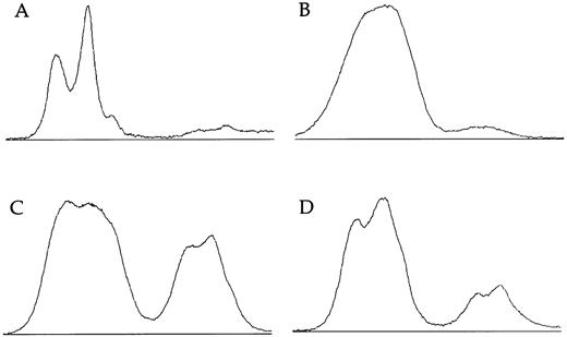 Fig. 3. Densitometry plots of X-inactivation analysis. Individual lanes showing amplification of the HUMARA gene after Hpa II digestion are plotted using the NIH image program. Autoradiographs were exposed for less than 16 hours. (A) The incompletely skewed female shown in lane 12 of Fig 2 (family 6, II:4). (B) The other incompletely skewed female from an X-linked family (family 005, III:3). (C) The mother of an affected boy from the family with an uncertain pattern of inheritance (family 009, II:12). (D) Her sister (family 009, II:1).