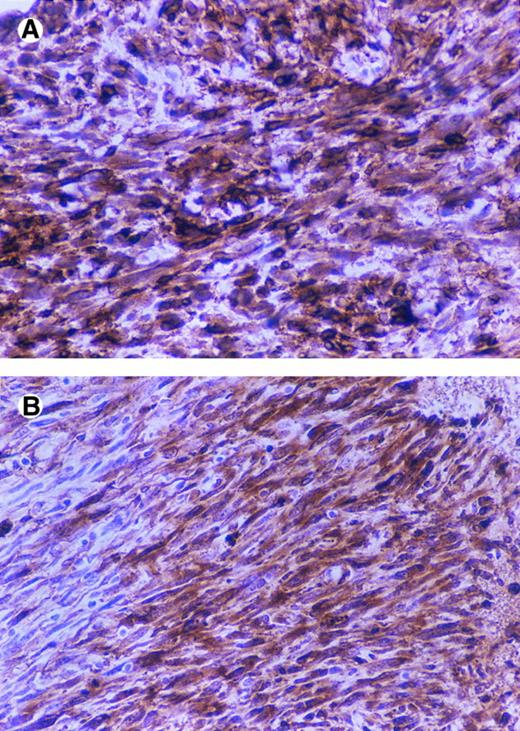 Fig. 10. Immunostaining of CD44 and SV40 large T in tumors. BALB/c nude mice were injected subcutaneously with 5 × 106 cells (5 mice/cell line) and after 2 months were sacrificed and tumors were fixed in formalin and paraffin embedded sections and immunostained by using an anti-SV40 large T antibody and the anti-CD44 antibody KM201.CD44-positive tumor (A and B), CD44-negative tumor (C and D), anti-CD44 (A and C), and anti-SV40 large T (B and D).