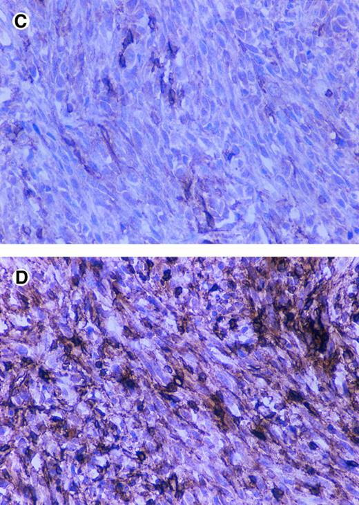 Fig. 10. Immunostaining of CD44 and SV40 large T in tumors. BALB/c nude mice were injected subcutaneously with 5 × 106 cells (5 mice/cell line) and after 2 months were sacrificed and tumors were fixed in formalin and paraffin embedded sections and immunostained by using an anti-SV40 large T antibody and the anti-CD44 antibody KM201.CD44-positive tumor (A and B), CD44-negative tumor (C and D), anti-CD44 (A and C), and anti-SV40 large T (B and D).
