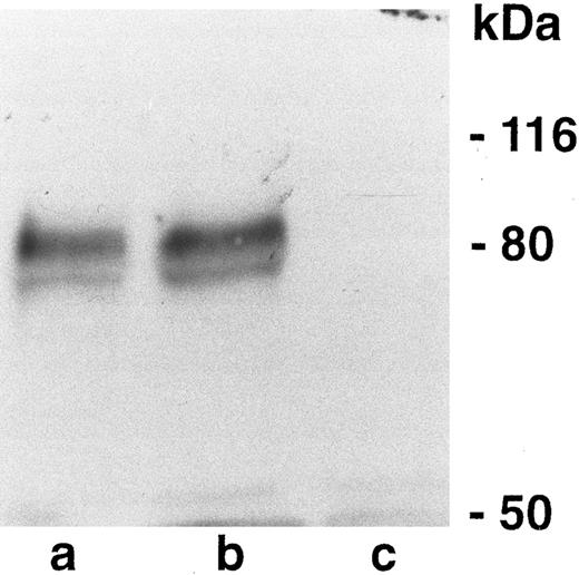 Fig. 9. Western blot analysis of CD44 in CD44-negative and -positive fibroblasts. (a) CD44 positive (pooled clones). (b) CD44 positive (single clone). (c) CD44 negative. Numbers on the right represent molecular weight markers.