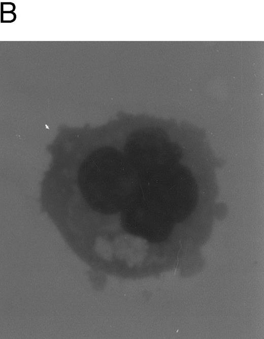 Fig. 1. Evaluation of TPO-induced proliferation and differentiation along the megakaryocytic lineage of CD34+ cells. In (A), viable cells were scored by Trypan blue dye exclusion after various days of liquid cultures supplemented with 100 ng/mL of TPO. Data are expressed as the means ± SD of three separate experiments performed in duplicate. In (B), cytospins were observed at light microscopy after May-Grünwald-Giemsa staining. Original magnification (OM) × 400.