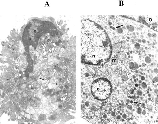 Fig. 2. Ultrastructural examination of CD34-derived megakaryocytes. In (A), a CD34-derived megakaryocyte illustrates demarcation membranes (arrows). n, nucleus. OM × 5,000. (B) shows a megakaryocyte with three sections of the nucleus (n) and various dense core granules (arrows). m, mitochondria. OM × 10,000.