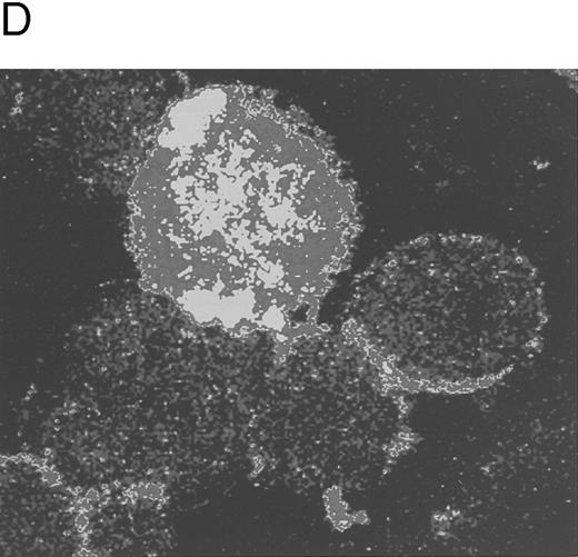 Fig. 4. Quantitative evaluation of apoptosis in CD34-derived megakaryocytes by the TUNEL technique. In (A) and (B), the intensity of fluorescence in the whole cell population was shown by flow cytometry at day 18 of liquid culture. (A) represents a negative control: cells treated with avidin-FITC. (B) shows a typical double profile in which the left area represents viable cells overlapping the negative control and the right area represents apoptotic cells that incorporate the biotin-UTP FITC-avidin complex. The × axis shows the relative fluorescence intensity. The y axis shows the relative number of cells. (C) shows the percentage of apoptosis evaluated by TUNEL technique and shown by flow cytometry at different culture times. Data are expressed as the means ± SD of four separate experiments performed in duplicate. In (D), apoptotic megakaryocytes appeared as intensively yellow-green fluorescent cells at confocal microscopy.