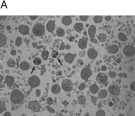 Fig. 6. Examination of morphology (A) and counts (B) of platelets released in the culture supernatants by CD34-derived megakaryocytes. (A) shows semithin sections with the presence of apoptotic (arrows) megakaryocytes surrounded by clusters of platelet-size fragments (*). OM × 40. In (B), gel-filtered platelets were counted at different culture times. Data are expressed as the means ± SD of three separate experiments performed in duplicate.