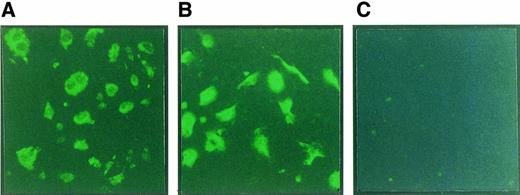 Fig. 1. Immunofluorescence staining of FLT-4 and FLK-1 in TrHBMEC. TrHBMEC were cultured in chamber slides and fixed with 4% paraformaldehyde. After blocking, the cells were immunostained with antibodies to FLT-4 (A) or FLK-1 (B), followed by secondary antibodies conjugated with FITC. Normal rabbit IgG was used as a negative control (C). HUVEC were used as a positive control for FLK-1 expression (data not shown).