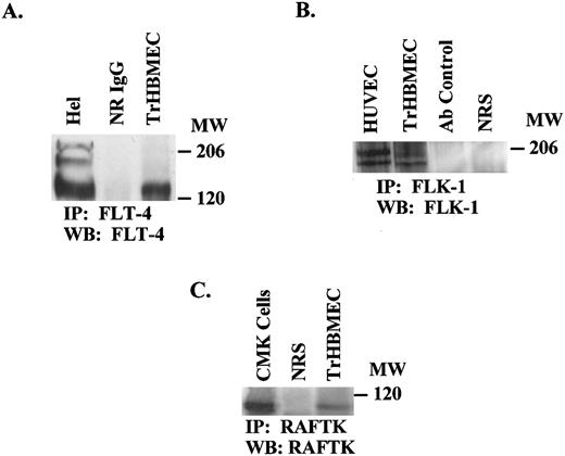 Fig. 2. Expression of FLT-4 and FLK-1 in TrHBMEC. TCL (1 mg) from TrHBMEC were immunoprecipitated with the anti–FLK-1 antibody or FLT-4 antibody. Immunoprecipitates were size-fractionated on 7.5% SDS-PAGE, transferred onto a nitrocellulose membrane, and then immunoblotted with FLK-1 or FLT-4 antibodies. For FLK-1 expression, positive controls consisted of the same amounts of TCL from HUVEC. For FLT-4 expression, HEL-JW cells were used as a positive control. Normal rabbit serum and antibody alone were used as negative controls.