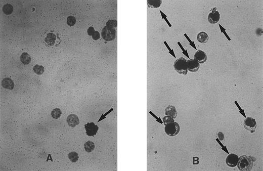 Fig. 2. Representative fields of cells showing unlabeled and labeled nuclei at 0 hours (A) and 30 hours (B) after cytokine stimulation of Lin− Rholow/Holow cells. Experimental procedure for the sorting of the stem cells, their labeling with 3H-thymidine, autoradiography, and Giemsa staining are as described in the Materials and Methods. Cells with labeled nuclei are indicated by arrows.