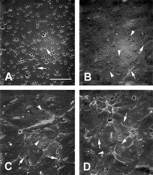 Fig. 7. dgRTA-induced morphologic changes. HUV-EC-C monolayers were cultured on the collagen IV-coated microporous cell culture inserts and treated as they were in the TEFF assays. SEM images represent (A) naked microporous membranes, (B) untreated control monolayers, (C) monolayers treated with 10−7 mol/L dgRTA for 96 hours, or (D) monolayers treated with 1 μg/mL cytochalasin D for 15 minutes. All photomicrographs were taken at 500× magnification using a tilt angle of 45°. The bar in (A) represents 50 μm; the original magnifications for (B) through (D) are the same as (A). Arrows indicate exposed pores and arrowheads indicate pores covered by endothelial cells.