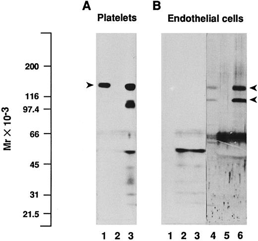 Fig. 4. Immunoblotting and immunoprecipitation analysis of platelet and endothelial cell protein extracts. Triton X-100–soluble proteins from platelets (A) or from endothelial cells (B) were analyzed directly by immunoblotting (lanes 1 and 4) or after immunoprecipitation with the MoAb SZ2 to GPIbα (lanes 3), with the irrelevant monoclonal IgG MOPC21 (lanes 2 and 5), or with the MoAb 23C6 to the αvβ3 integrin complex (lane 6). Proteins were separated by SDS-PAGE under reduced conditions, transferred to nitrocellulose membranes, and immunoblotted with a polyclonal antiserum to GPIbα (lanes 1 to 3, 2 days of exposure on film) or with a mixture of two polyclonal antisera to each of the αv and β3 subunits (lanes 4 through 6, 1 day of exposure on film), as detailed in the Materials and Methods. Immunoprecipitation of platelet lysates with SZ2 shows a major band in the position of platelet GPIbα, indicated by an arrowhead (A), whereas no such band is detected in endothelial cell immunoprecipitates. On (B), arrowheads depict the position of endothelial αv heavy chain and β3 subunits. Molecular mass markers are indicated on the left-hand side.