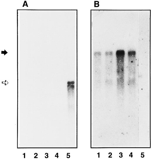 Fig. 5. Northern blot analysis of endothelial GPIbα mRNA. Poly(A+) mRNA were extracted and analyzed by Northern blot using radiolabeled GPIbα cDNA (A) or vWF cDNA (B) as the probe in the different cell extracts: primary endothelial cells (4 × 106 cells, lanes 1 and 2), second passage endothelial cells (7 × 106 cells, lanes 3 and 4), and HEL 5J20 cells (7 × 106 cells, lane 5). mRNA expression was observed in unstimulated (lanes 1 and 3) endothelial cells or after TNFα treatment (lanes 2 and 4). The position of GPIbα mRNA is indicated by an open arrow corresponding to 2.8 kb, whereas vWF mRNA band is shown by a solid arrow (9 kb).
