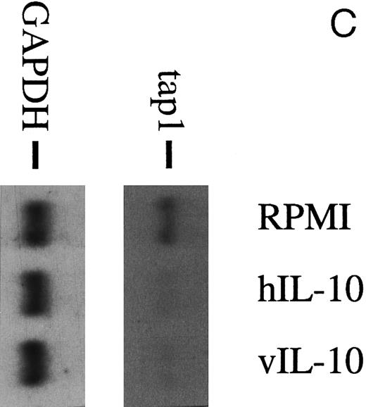 Fig. 2. (A) TAP1 mRNA levels in primary B cells from two different donors are strikingly reduced after incubation with either B95.8 supernatant (labeled B95.8) or VFS (labeled VFS) in comparison with cells incubated with culture medium only (labeled RPMI). (B) The TAP1 mRNA level is not reduced with cell culture supernatant derived from the EBV-negative, IL-10–negative cell line DG7524 in comparison with reduced levels detected after treatment with B95.8 supernatant. (C) Cell culture medium (RPMI with 10% fetal calf serum) with appropriate dilutions of recombinant vIL-10 and hIL-10 from transiently transfected Cos7 cells causes the same reduction of TAP1 steady-state mRNA levels in primary B lymphocytes as does treatment with B95.8 shown in (A). B lymphocytes from two different donors were analyzed in parallel. (D) TAP1 mRNA steady-state level is reduced in tonsillar B cells after incubation with commerially available recombinant human IL-10 in a dose-dependent manner.