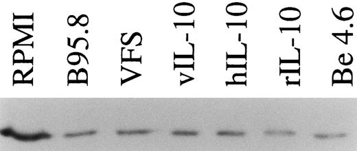 Fig. 3. TAP1 protein levels in primary tonsillar B lymphocytes are reduced to about one third after incubation with IL-10 or IL-10 containing supernatants (supernatant from B95.8 cells, VFS, supernatant-derived Cos7 cells transiently transfected with expression plasmids of hIL-10 and vIL-10, or 0.03 μg/mL purified rIL-10) in comparison with cell culture medium (RPMI). After 48 hours of incubation, TAP1 protein is reduced but still detectable, presumably due to its extended protein half life. An in vitro-generated LCL (Be 4.6, lane 7) produces significantly lower levels of TAP1 as compared with primary B cells. Equal amounts of total cellular protein were loaded in each lane. TAP1 protein was visualized after Western blotting with a monoclonal antibody directed against TAP1.