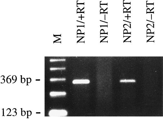Fig. 4. Primary B lymphocytes from adenoids express BCRF1 early after infection with B95.8 virus as determined by RT-PCR with BCRF1-specific primers (+RT). Total cellular RNA preparations from nasal polyps of two different donors (NP1 and NP2) were used. No PCR amplification product could be detected when reverse transcriptase was omitted, as shown in lanes labeled −RT, as a negative control. M indicates the 123-bp ladder as a molecular weight marker.