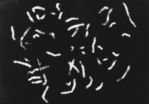 Fig. 3. Chromosomal localization of HLy9-β gene. Metaphase showing FISH with the HLy9-β 5.4-kb genomic probe. Double spots of hybridization signal on chromosome 1 is indicated by an arrow. The HLy9-β gene was assigned to 1q24.