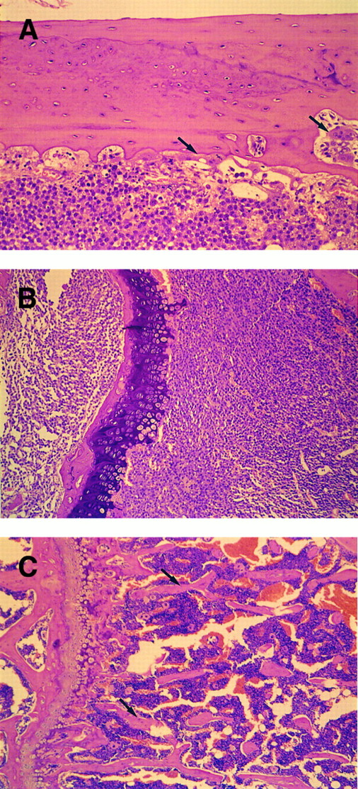 Fig. 4. Histologic observation of bone resorption in the mice IV inoculated with KPMM2 cells. (A, B) Tumor-bearing mouse. (C) Normal mouse. (A) Osteolytic lesions and osteoclastic cells (arrow) were observed in cortical bone surface. Bone marrow was occupied by tumor cells. (B) The end of femur. Spongy bone completely disappeared in IV transplanted mouse. (C) Spongy bone (arrow) was observed in normal mouse.