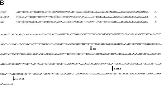 Fig. 3. t(14; 18) translocations. (A) Restriction map of the 3′ region of the BCL2 gene showing position of breakpoints cloned in this study. Note the clustering of breakpoints in the region of the pMW-1 probe and the variant breakpoint in Karpas 231. *Leukemia 380, breakpoint not characterized in this study but cloned previously.39 (B) Sequence of pMW region and breakpoint sequences in case no. 1, SU-DUL5, and 380. JH sequences are underlined and n regions are in lowercase. JH segment involved in translocation is shown. B, BamHI; E, EcoRI; H, HindIII.