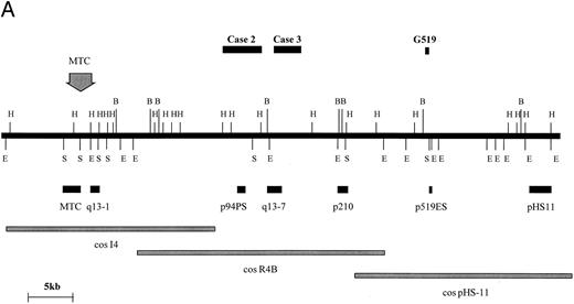 Fig. 4. BCL1 breakpoints. (A) Partial restriction map of the BCL1 locus illustrating cosmid and probe locations and breakpoints cloned in this study. Breakpoint of Granta 519 marked with its derived probe (p519ES, a 500-bp EcoRI/Sac I fragment). Note that this breakpoint falls within a window not covered by other probes. Map taken from Williams et al40 and Raynaud et al.41 (B) Sequences of breakpoints cloned in cases with t(11; 14); JH sequences are underlined and JH segment involved in breakpoint is shown. Bold type refers to Alu repeats. B, BamHI; E, EcoRI; H, HindIII; S, Sac I.