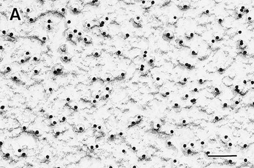 Fig. 2. Electron micrographs of RBC membrane skeletons by the surface replica method with antihuman protein 4.1 mouse monoclonal IgM antibody. No protein 4.1 was detected in the 4.1 (−) Madrid (B) as compared with normal subjects (A). Original magnification × 100,000. Bars indicate 0.1 μm.