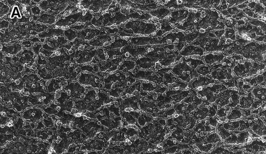 Fig. 3. Skeletal networks by EM with the QFDE method. Markedly disrupted skeletal networks are shown representatively in the 4.1 (−) Madrid (B) as compared with normal subjects (A). These results are also shown schematically in normal (C) and in the 4.1 (−) Madrid (D). Original magnification × 150,000. Bars indicate 0.1 μm.