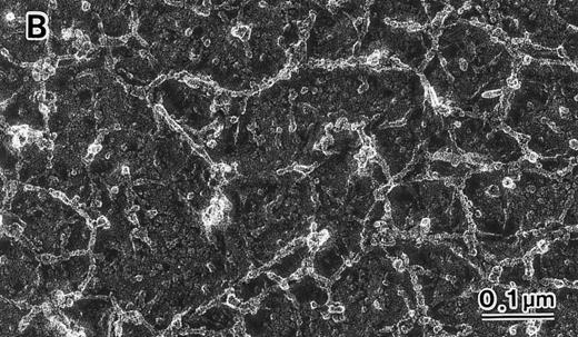 Fig. 3. Skeletal networks by EM with the QFDE method. Markedly disrupted skeletal networks are shown representatively in the 4.1 (−) Madrid (B) as compared with normal subjects (A). These results are also shown schematically in normal (C) and in the 4.1 (−) Madrid (D). Original magnification × 150,000. Bars indicate 0.1 μm.