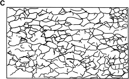 Fig. 3. Skeletal networks by EM with the QFDE method. Markedly disrupted skeletal networks are shown representatively in the 4.1 (−) Madrid (B) as compared with normal subjects (A). These results are also shown schematically in normal (C) and in the 4.1 (−) Madrid (D). Original magnification × 150,000. Bars indicate 0.1 μm.