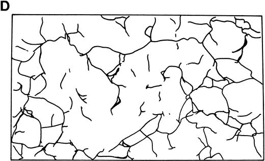 Fig. 3. Skeletal networks by EM with the QFDE method. Markedly disrupted skeletal networks are shown representatively in the 4.1 (−) Madrid (B) as compared with normal subjects (A). These results are also shown schematically in normal (C) and in the 4.1 (−) Madrid (D). Original magnification × 150,000. Bars indicate 0.1 μm.
