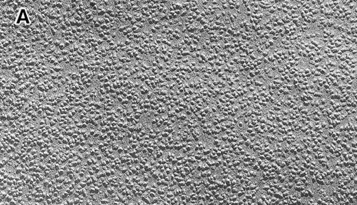 Fig. 6. Intramembrane particles at the inner (so-called “P”) face by EM with the FF method. No quantitative abnormalities were detected in the 4.1 (−) Madrid case (B), as compared with normal subjects (A). However, regular distribution was lost with many clusters of various sizes in the 4.1 (−) Madrid case (B). Many irregularly and widely open membrane areas with a much smaller number of IMPs were also observed (B). Original magnification × 150,000. Bars indicate 0.1 μm.
