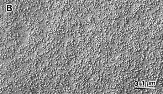Fig. 6. Intramembrane particles at the inner (so-called “P”) face by EM with the FF method. No quantitative abnormalities were detected in the 4.1 (−) Madrid case (B), as compared with normal subjects (A). However, regular distribution was lost with many clusters of various sizes in the 4.1 (−) Madrid case (B). Many irregularly and widely open membrane areas with a much smaller number of IMPs were also observed (B). Original magnification × 150,000. Bars indicate 0.1 μm.