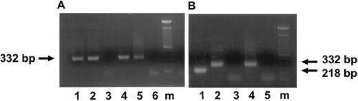 Fig. 1. Detection of HCMV DNA and IE transcripts in HCMV-infected CD34+ progenitor cells 3 and 7 days postinfection. (A) Ethidium bromide-stained 1% agarose gel of PCR products for HCMV DNA (lanes 1 through 3) and of RT-PCR for IE transcripts (lanes 4 through 6; 3 days postinfection). The arrow indicates the IE PCR and RT-PCR products of 332 bp. Lane 1, DNA from CD34+ cells infected with HCMV strain 95(2); lane 2, DNA from CD34+ cells infected with Towne/lox2; lane 3, DNA from mock-infected CD34+ cells; lane 4, RNA from CD34+ cells infected with 95(2); lane 5, RNA frm CD34+ cells infected with Towne/lox2; lane 6, RNA from mock-infected CD34+ cells. (B) Ethidium bromide-stained 1% agarose gel of RT-PCR products of an IE transcripts (7 days postinfection) using primers spanning exons 1 and 2. The arrows indicate the RT-PCR products of spliced IE transcripts of 218 bp and unspliced IE transcripts of 332 bp. Lane 1, RNA from CD34+ cells infected with 95(2); lane 2, RNA from CD34+ cells infected with Towne/lox2; lane 3, RNA from mock-infected CD34+ cells; lane 4, positive control of HCMV-infected fibroblasts amplified from DNA displaying genomic size (332 bp) banding pattern; lane 5, RT-PCR H2O control. All RNA samples were treated with Rnase-free Dnase. Lane m, 100-bp ladder (GIBCO/BRL). Primers and predicted PCR products are listed in Table 1.