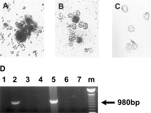 Fig. 4. HCMV persistence in the progeny derived from infected CD34+ cells. (A) X-gal staining of the colonies derived from CD34+ cells infected with Towne/lox2 in methylcellulose cultures 14 days postinfection. Original magnification × 320. (B) X-gal staining of the progeny derived from CD34+ cells infected with Towne/lox2 in suspension cultures 28 days postinfection. Original magnification × 200. (C) Progeny derived from mock-infected CD34+ cells stained as in (A) and (B). Original magnification × 200. Cells from the colonies and suspension cultures were stained with X-gal (150 μg/mL) for 6 hours. (D) PCR detection of β-gal DNA in the progeny derived from CD34+ cells infected with Towne/lox2. PCR products were electrophoretically separated in 1% agarose gels stained with ethidium bromide. The arrow indicates a β-gal DNA PCR product of 900 bp. Lanes 1 through 3, DNA from colonies derived from infected and mock-infected CD34+ cells; lanes 4 through 6, DNA from suspension cultures derived from infected and mock-infected CD34+ cells. Lanes 1 and 4, DNA from the cultures infected with 95(2); lanes 2 and 5, DNA from the cultures infected with Towne/lox2; lanes 3 and 6, DNA from the cultures derived from mock-infected CD34+ progenitors; lane 7, PCR H2O control; lane m, 100-bp ladder (GIBCO/BRL). Primers used and predicted PCR products are listed in Table 1.