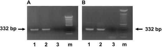 Fig. 5. Presence of HCMV DNA in the progeny derived from HCMV-infected CD34+ BM cells. (A) Ethidium bromide-stained 1% agarose gel of PCR for HCMV DNA in suspension cultures derived from HCMV-infected CD34+ cells 28 days postinfection. (B) Ethidium bromide-stained 1% agarose gel of PCR for HCMV DNA in colonies derived from infected CD34+ cells 14 days postinfection. The arrows indicate the IE PCR product of 332 bp. Lane 1, DNA from the cultures infected with 95(2); lane 2, DNA from the cultures infected with Towne/lox2; lane 3, DNA from the mock-infected cultures; lane m, 100-bp ladder (GIBCO/BRL).